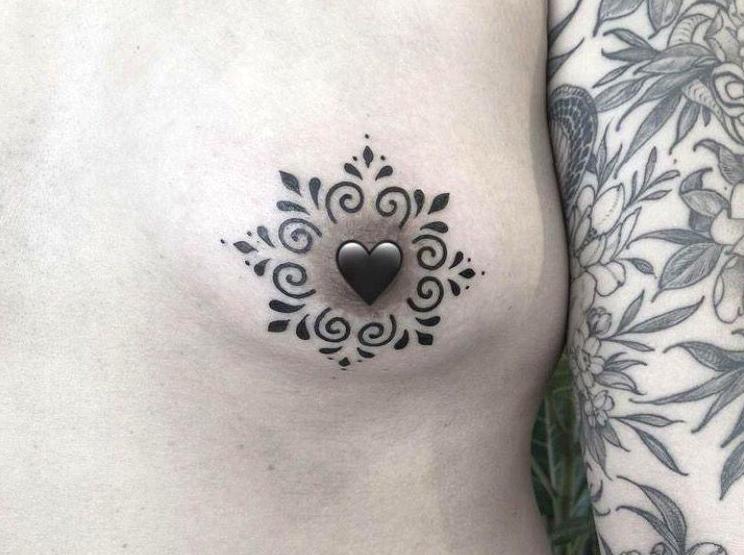 Restorative and Cosmetic Areola Solutions through Nipple Tattooing